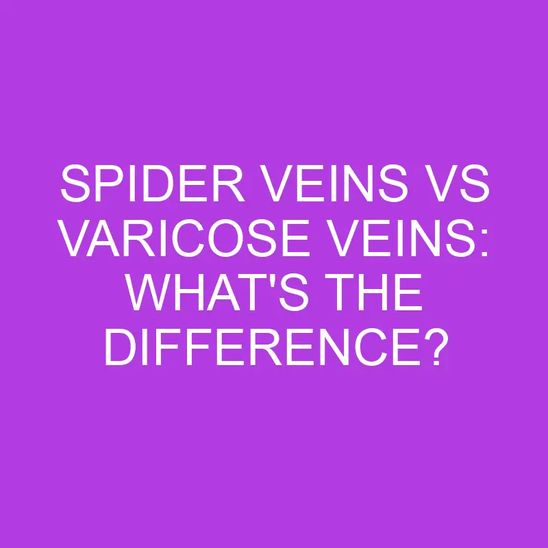 Spider Veins Vs Varicose Veins: What’s The Difference?